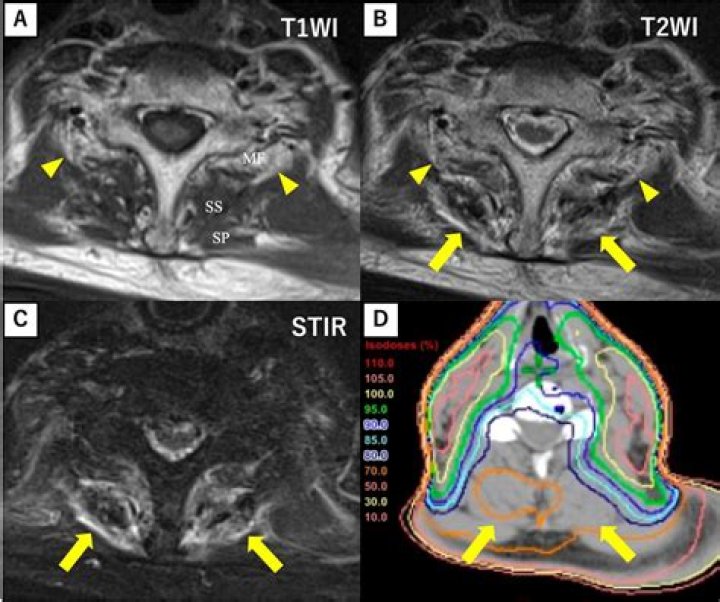 What is short tau inversion recovery