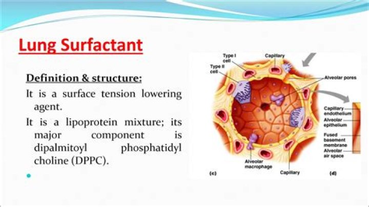 What is surfactant in lungs
