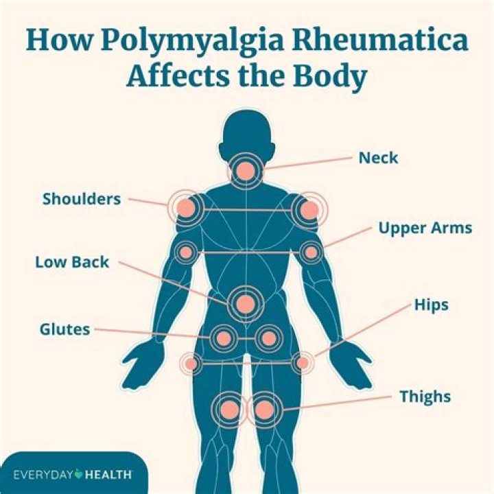 What is the difference between polymyositis and polymyalgia rheumatica