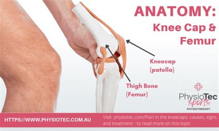 What is the kneecap made of