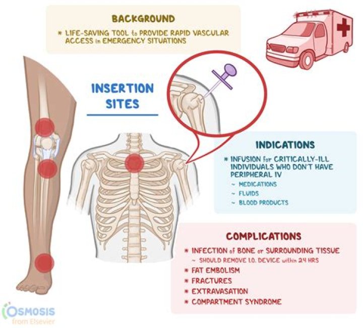 What is the meaning of intraosseous