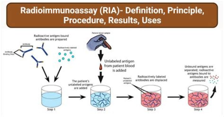 What is the principle of radioimmunoassay