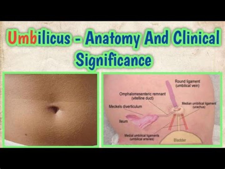What is the umbilical region called