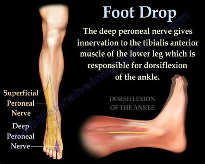 What nerve controls foot drop