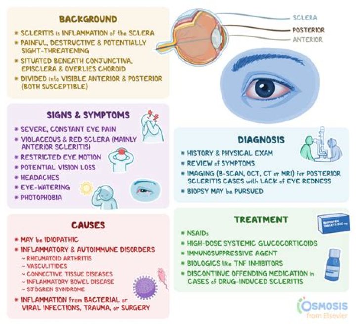 What triggers episcleritis