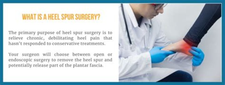 Whats the purpose of a spur