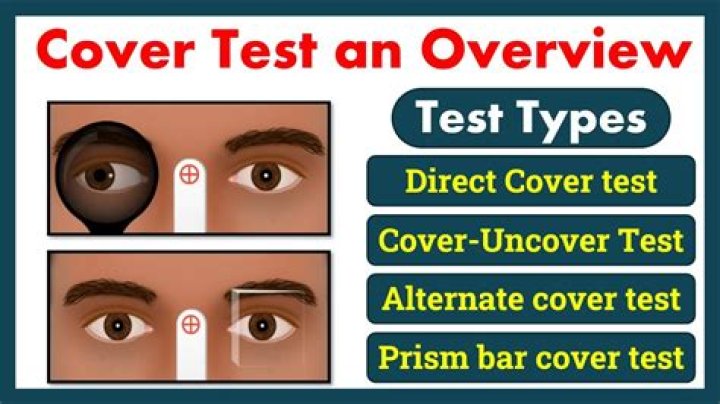 When do you do a cover test