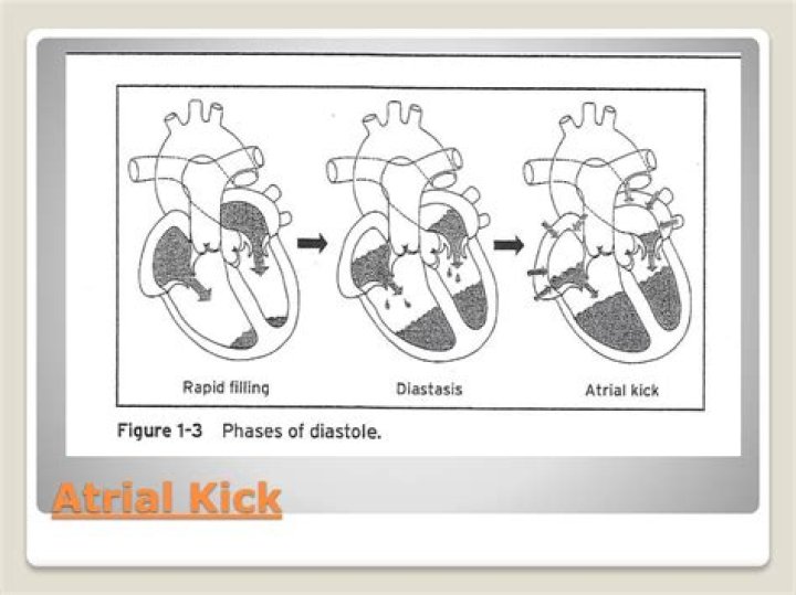 When does atrial kick occur