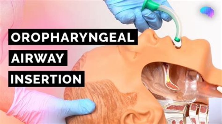 When would you use a Guedel Airway