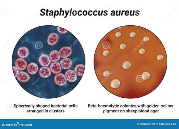 Where does Staphylococcus aureus grow