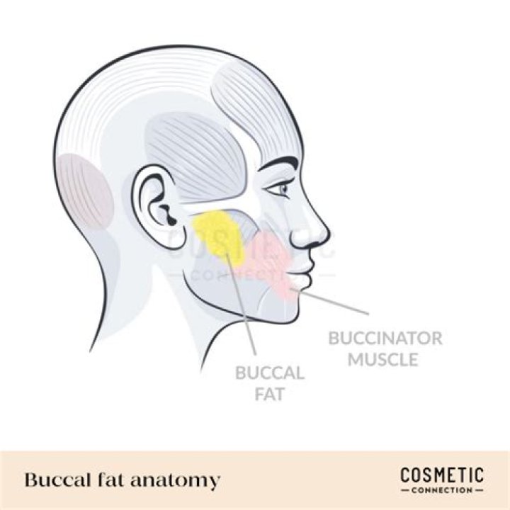 Where is buccal fat located