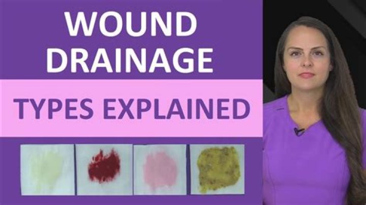 Why do wounds have exudate