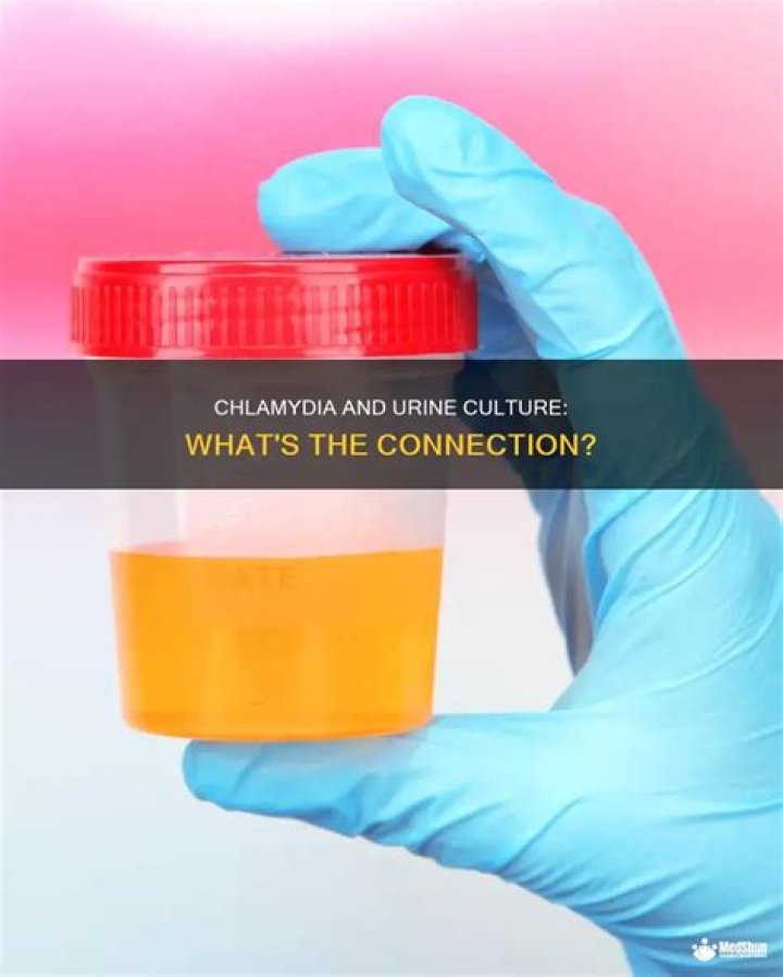 Will chlamydia show up in a urine culture